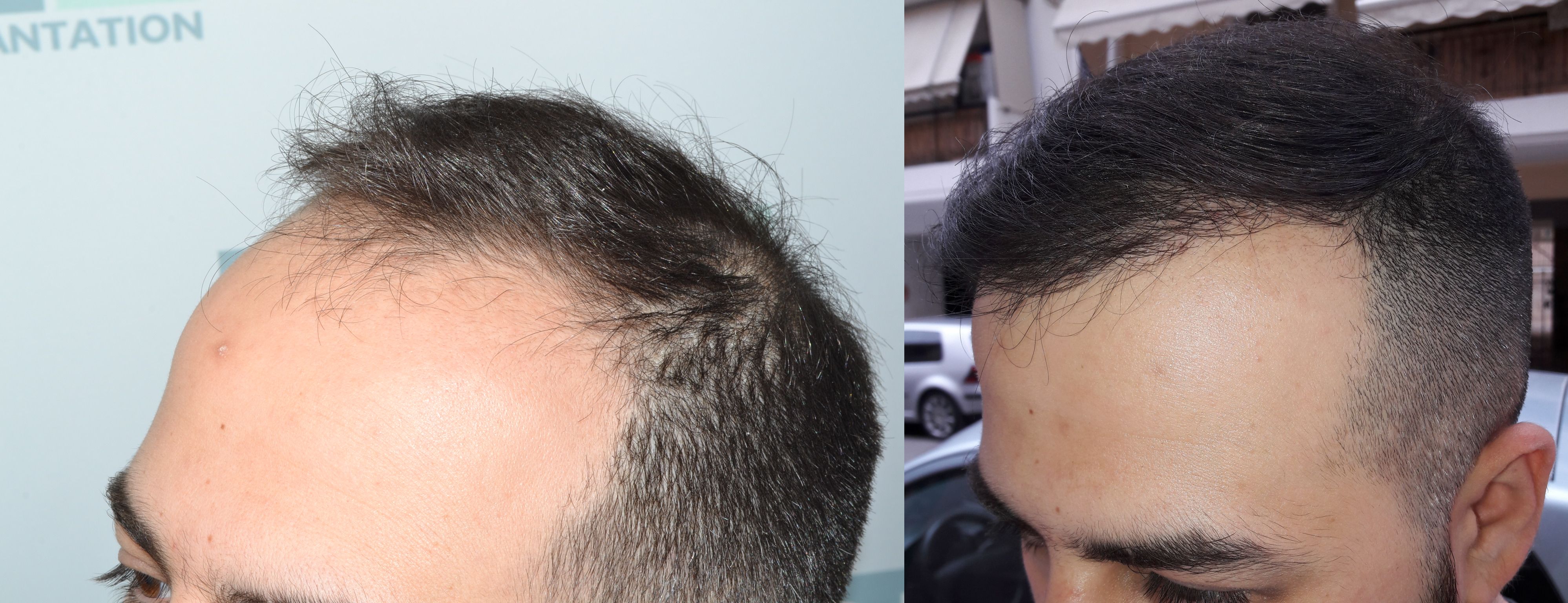before after left.jpg