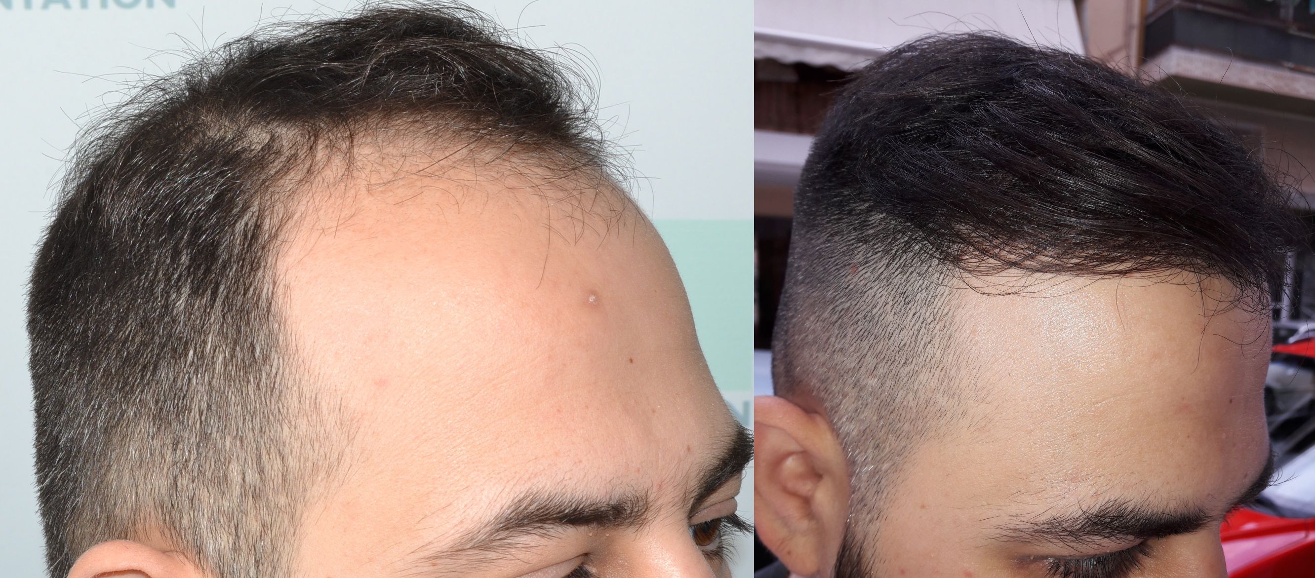 before after right.jpg