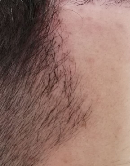 close up polytrixa.png