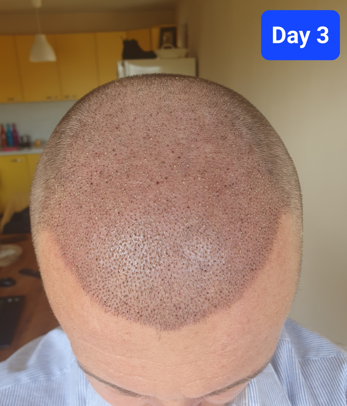 Day 3.PNG