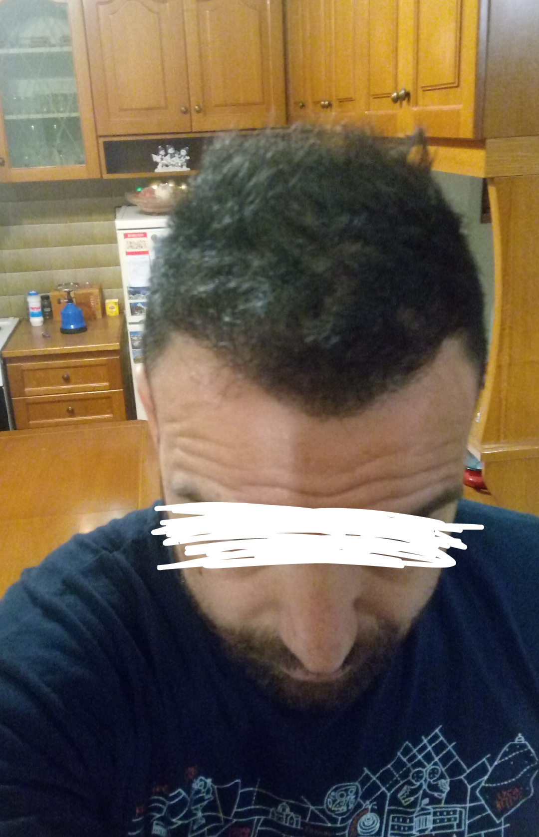 DEXATI20180429141320.png