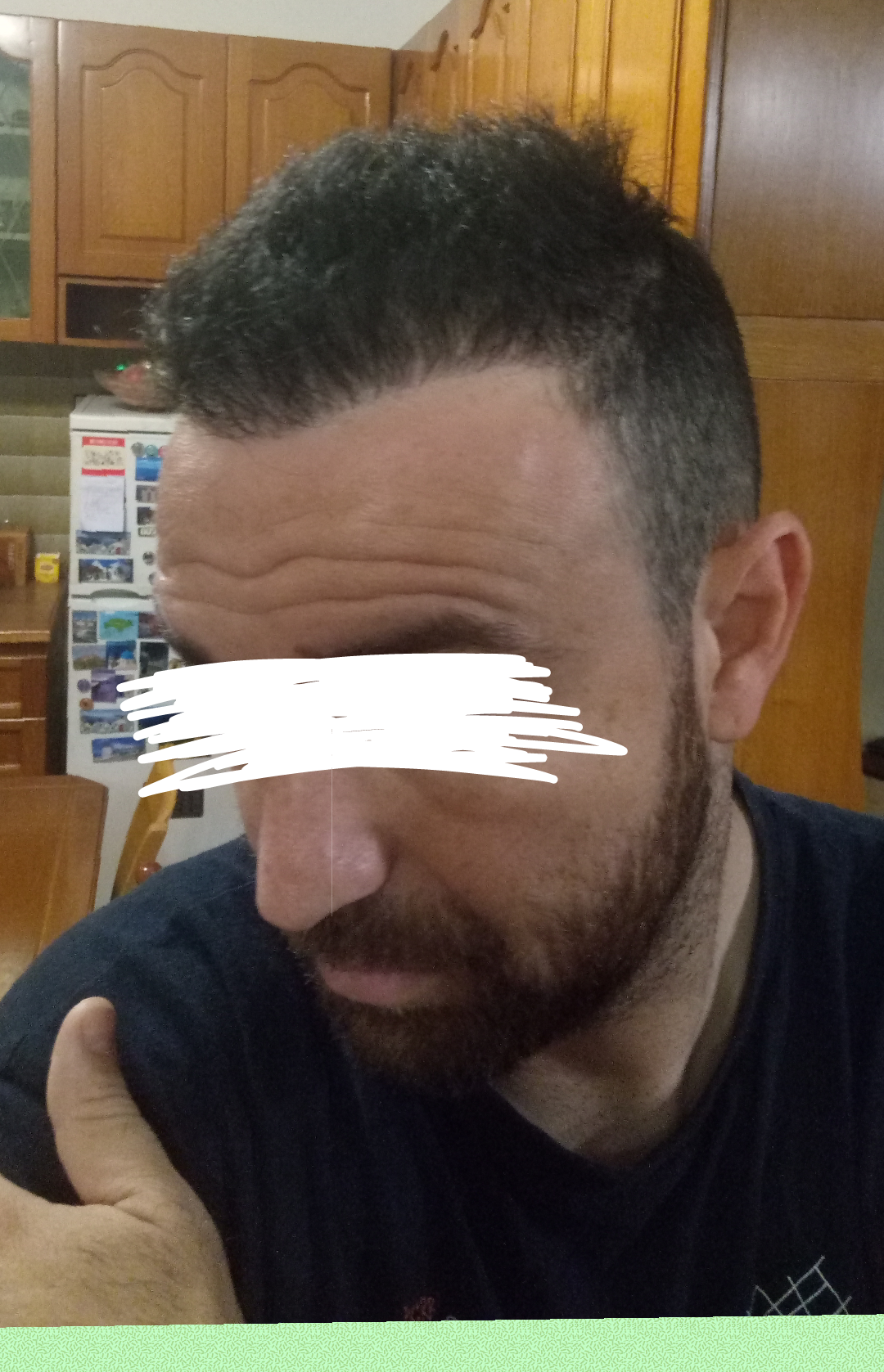 DEXATI20180429141411.png