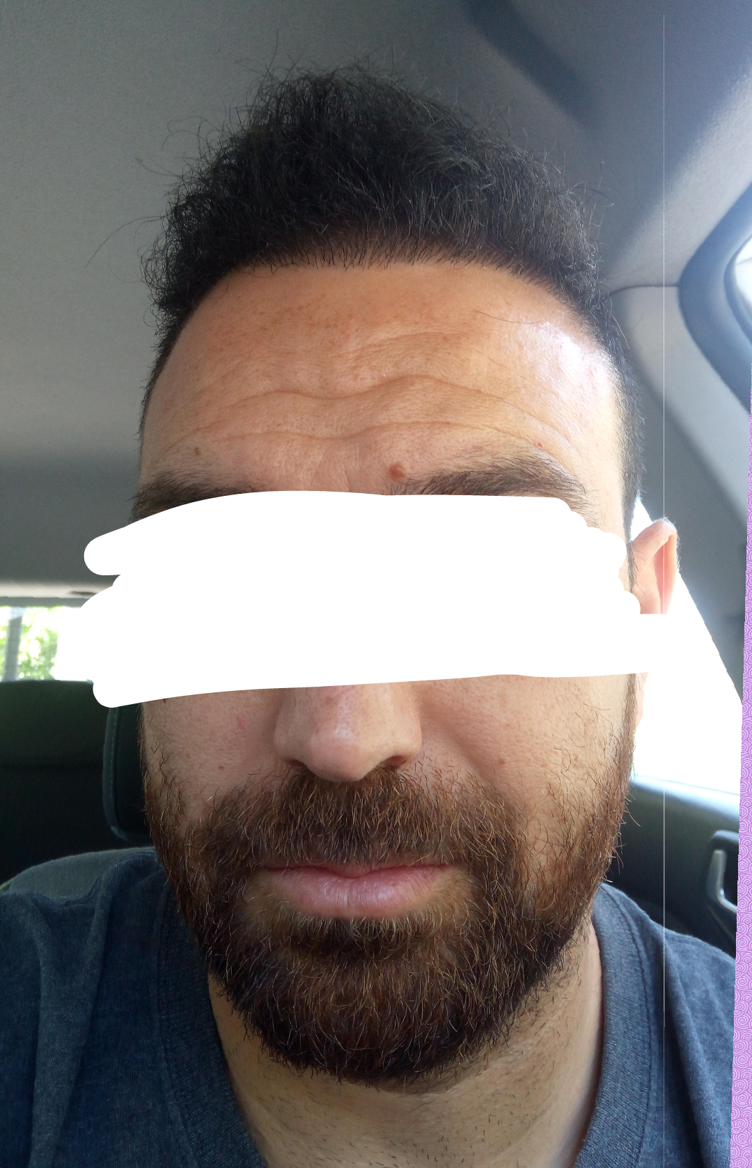 DEXATI20180605235123.png