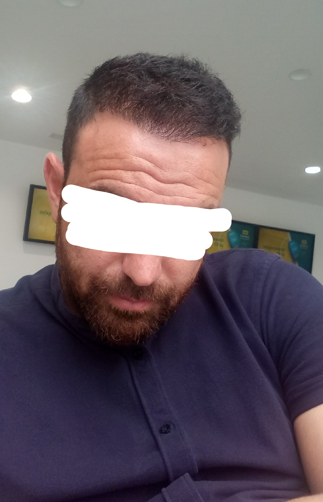 DEXATI20180611142455.png