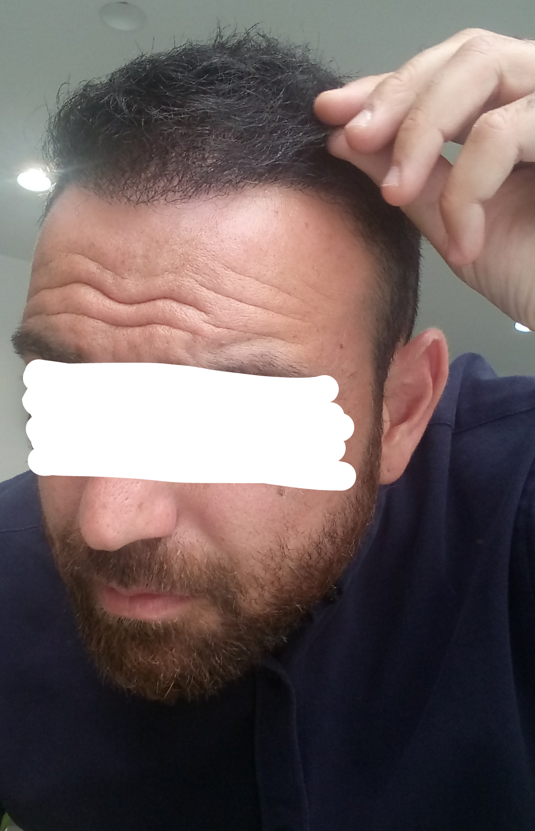 DEXATI20180611142548.png