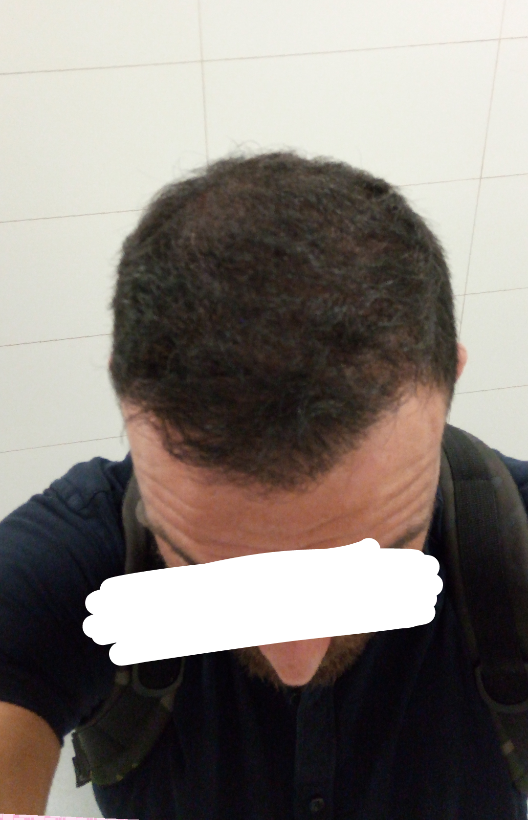 DEXATI20180611142749.png