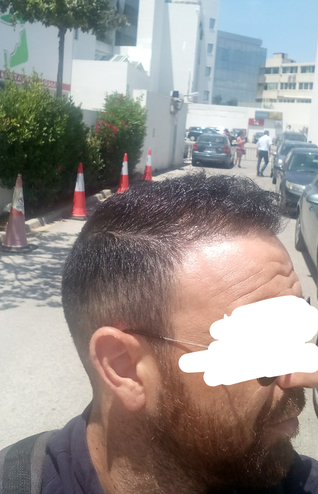 DEXATI20180611143112.png