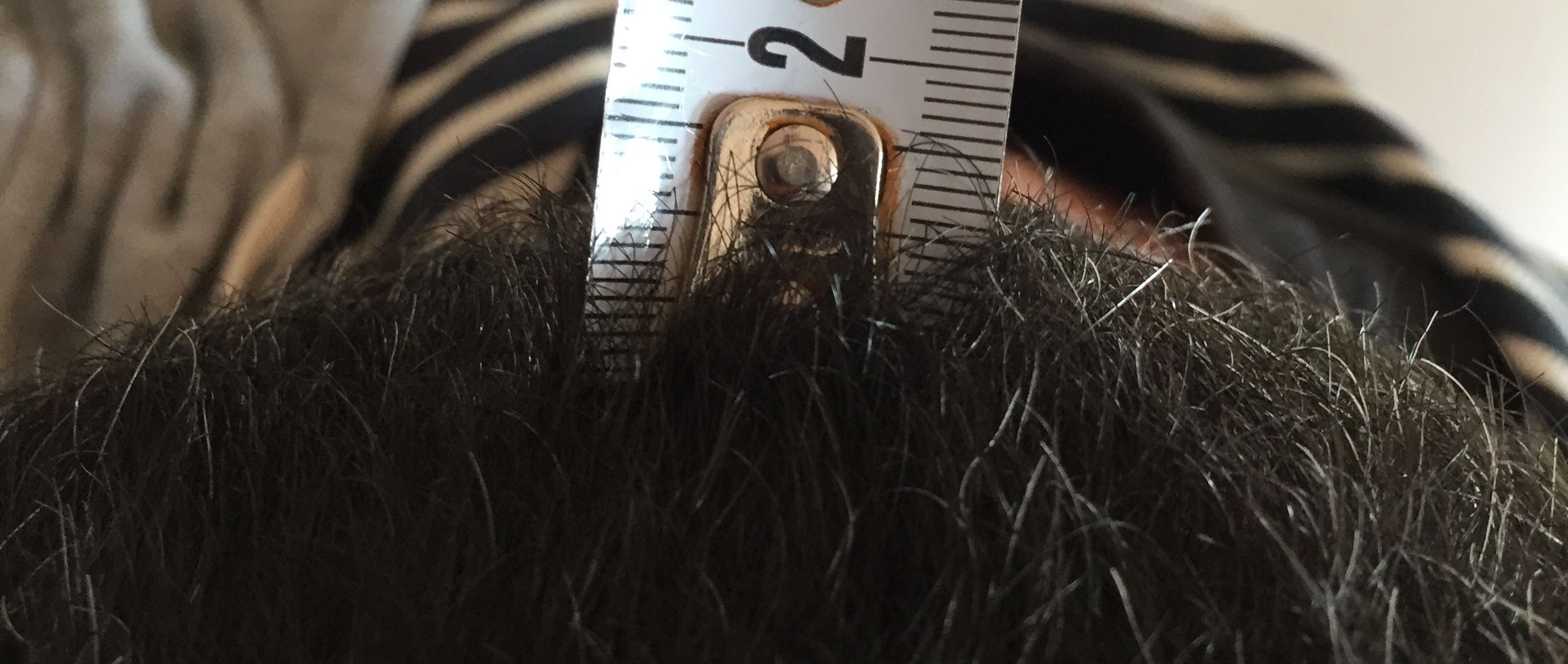 dimos donor measure.jpg