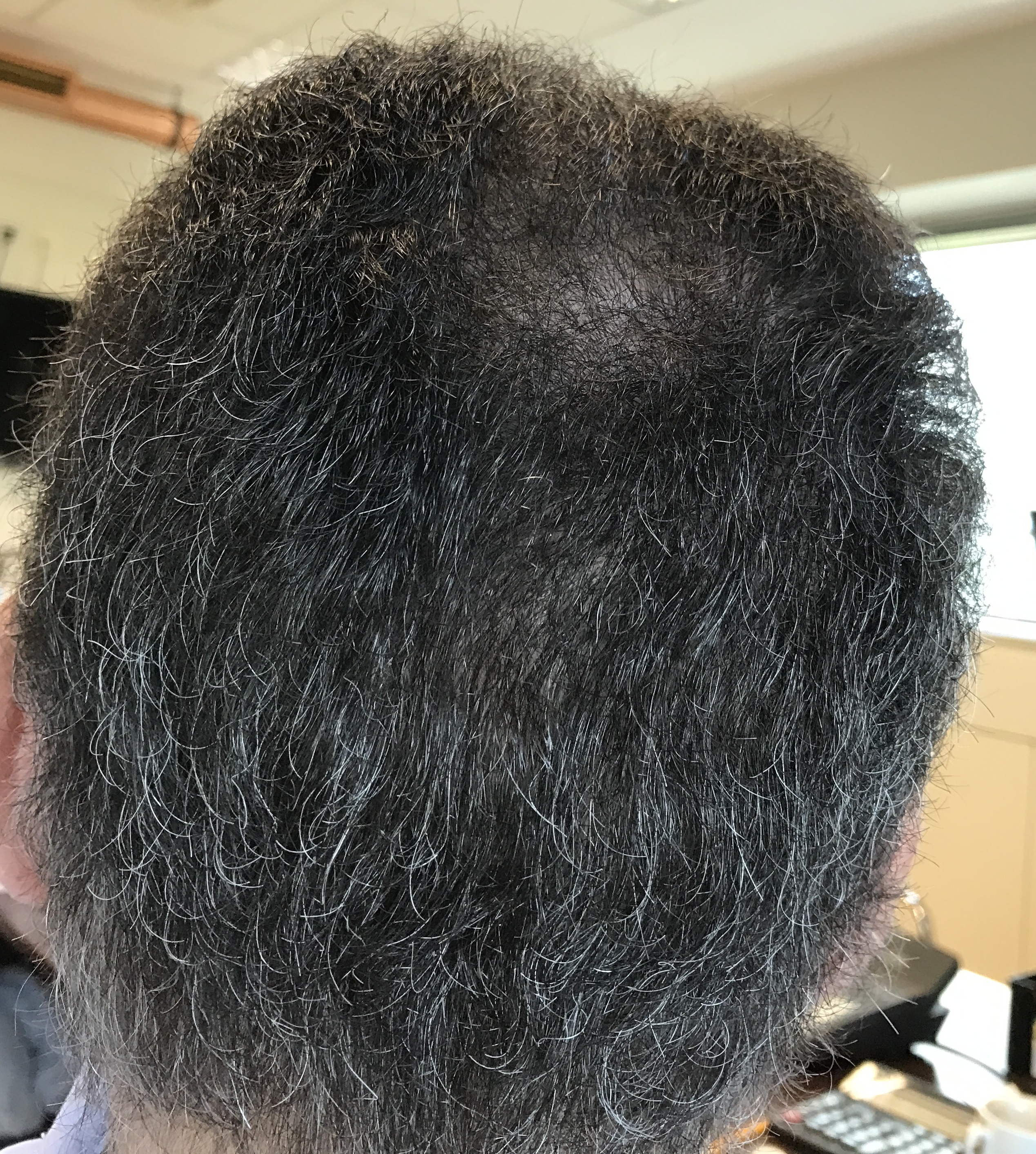 donor 3 months.jpg
