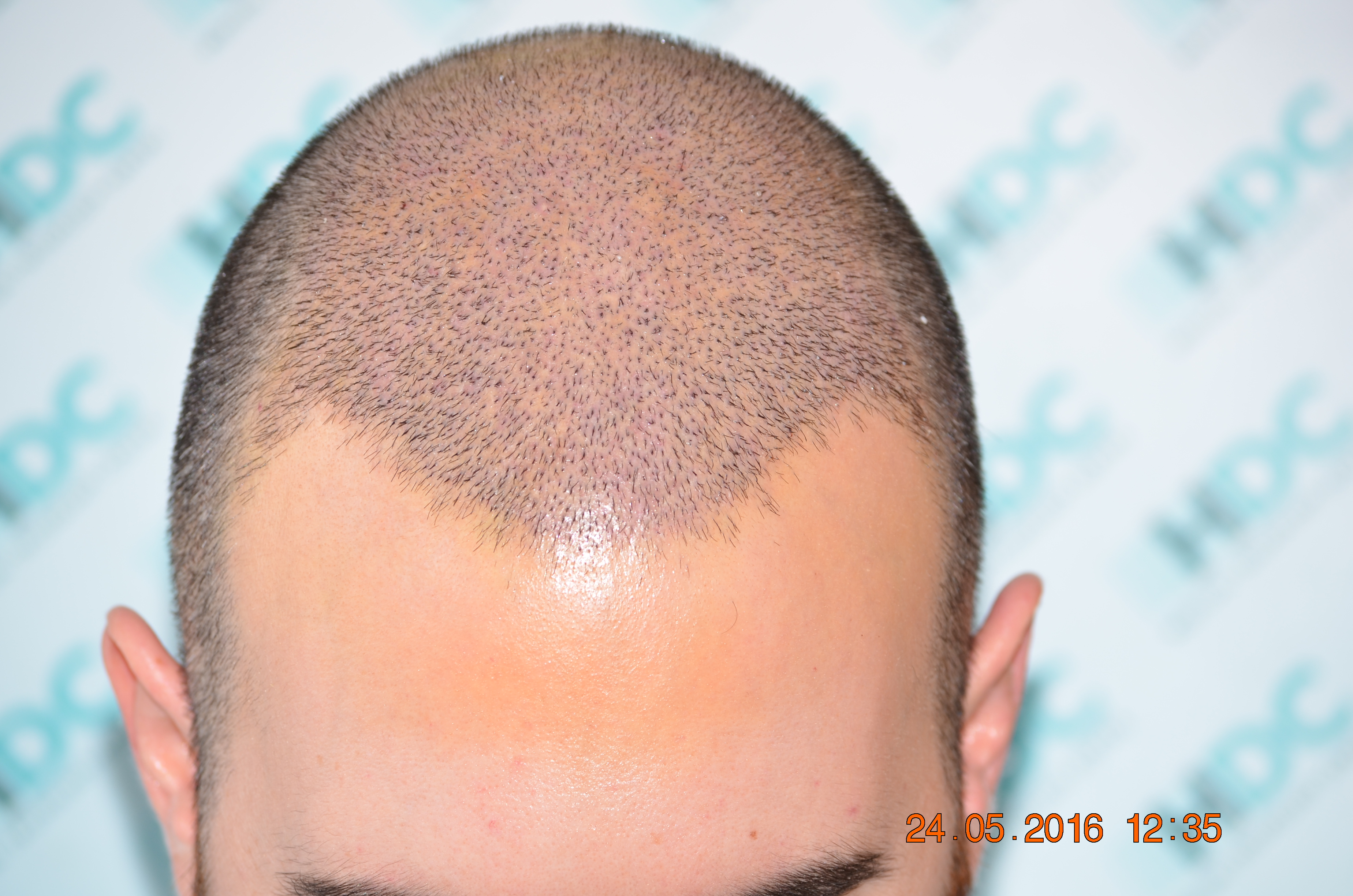DSC_1704.JPG