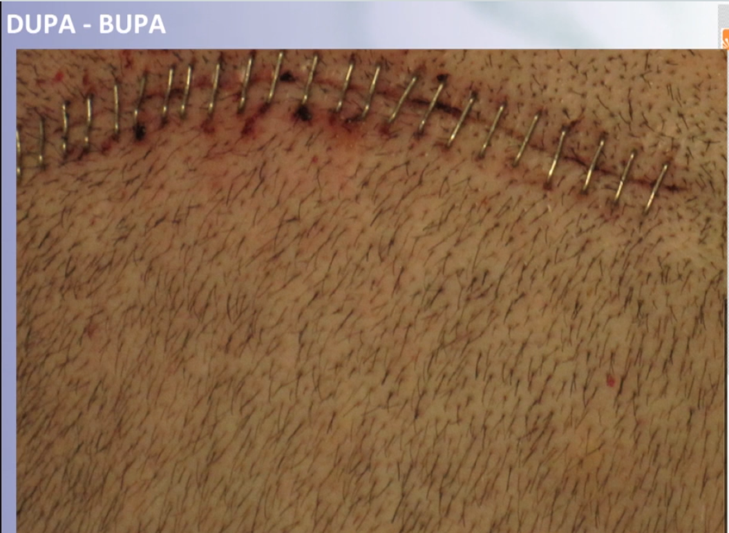 dupa34.png