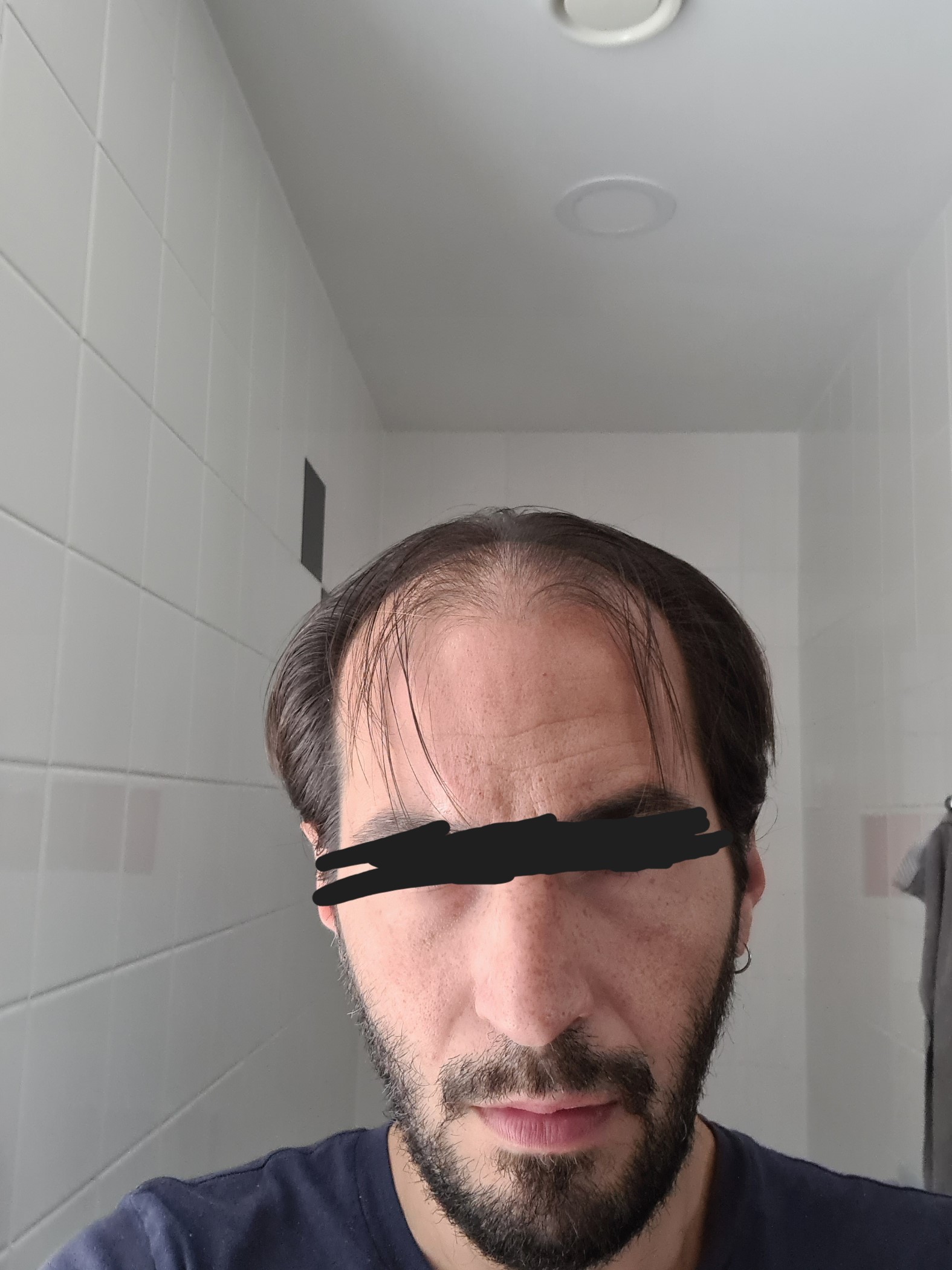FrontalUglyTruth.jpg