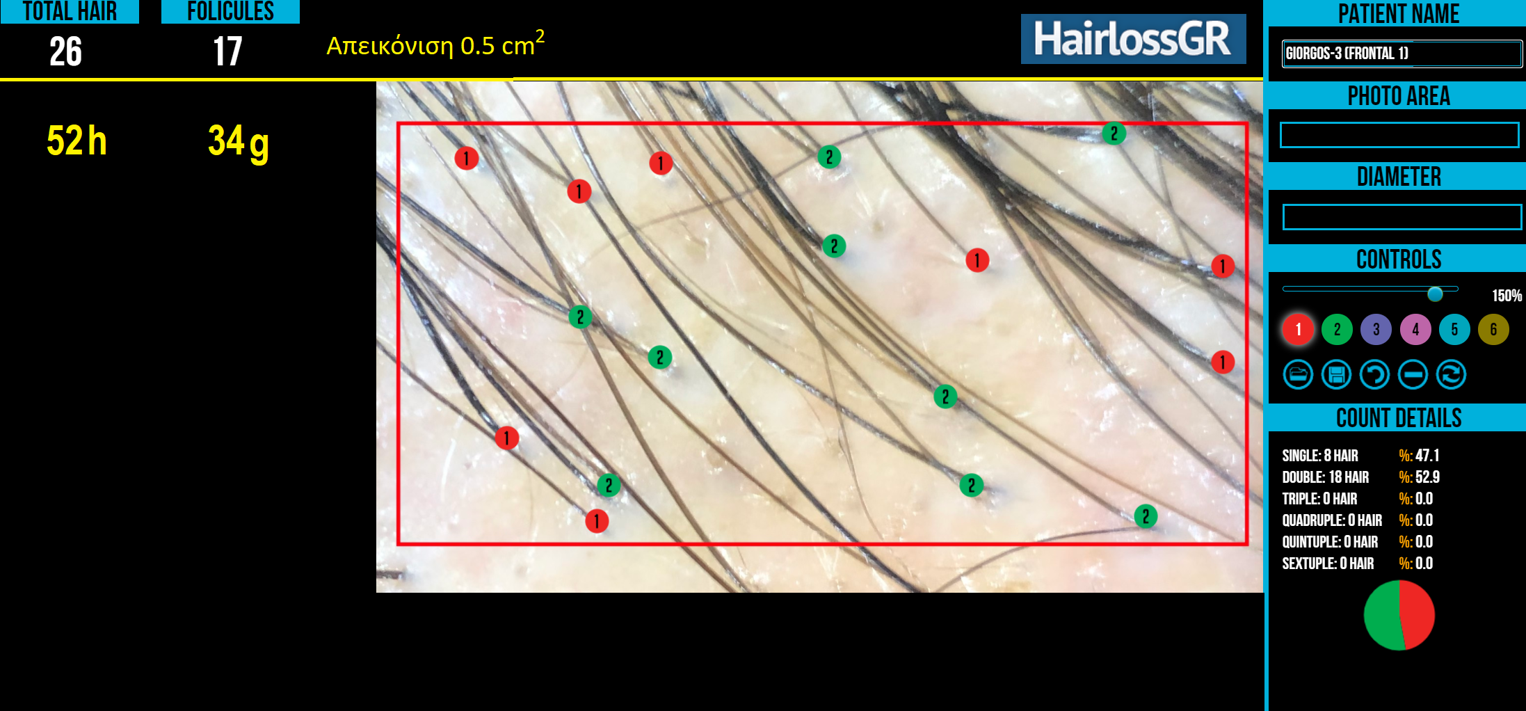 giorgos-3 frontal 2.png