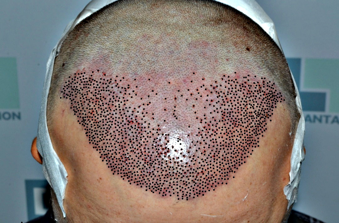 grafts - Copy.jpg