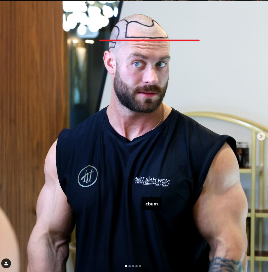 gtgtgtgtg.png