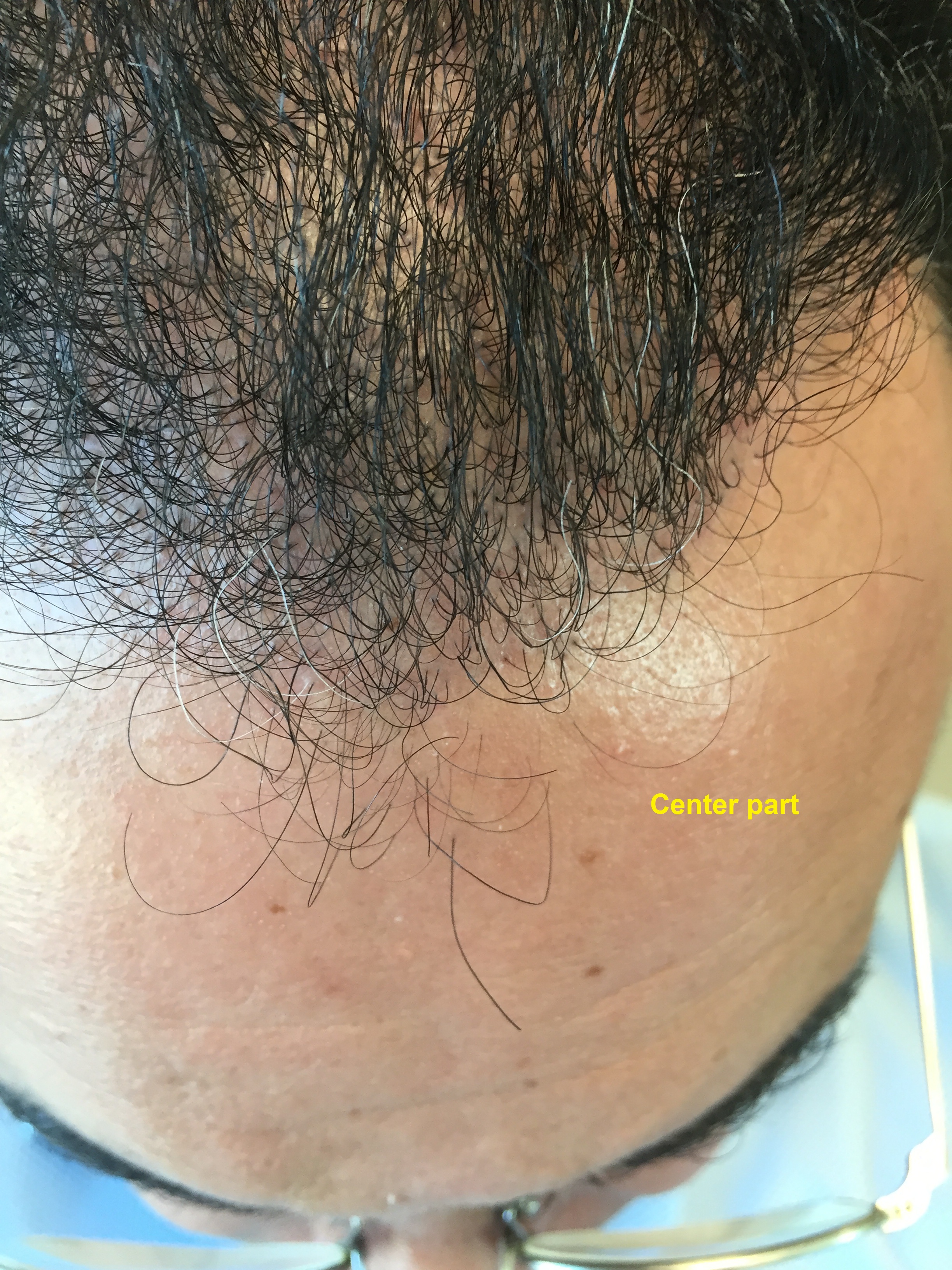 hairline 6m - 1.jpg