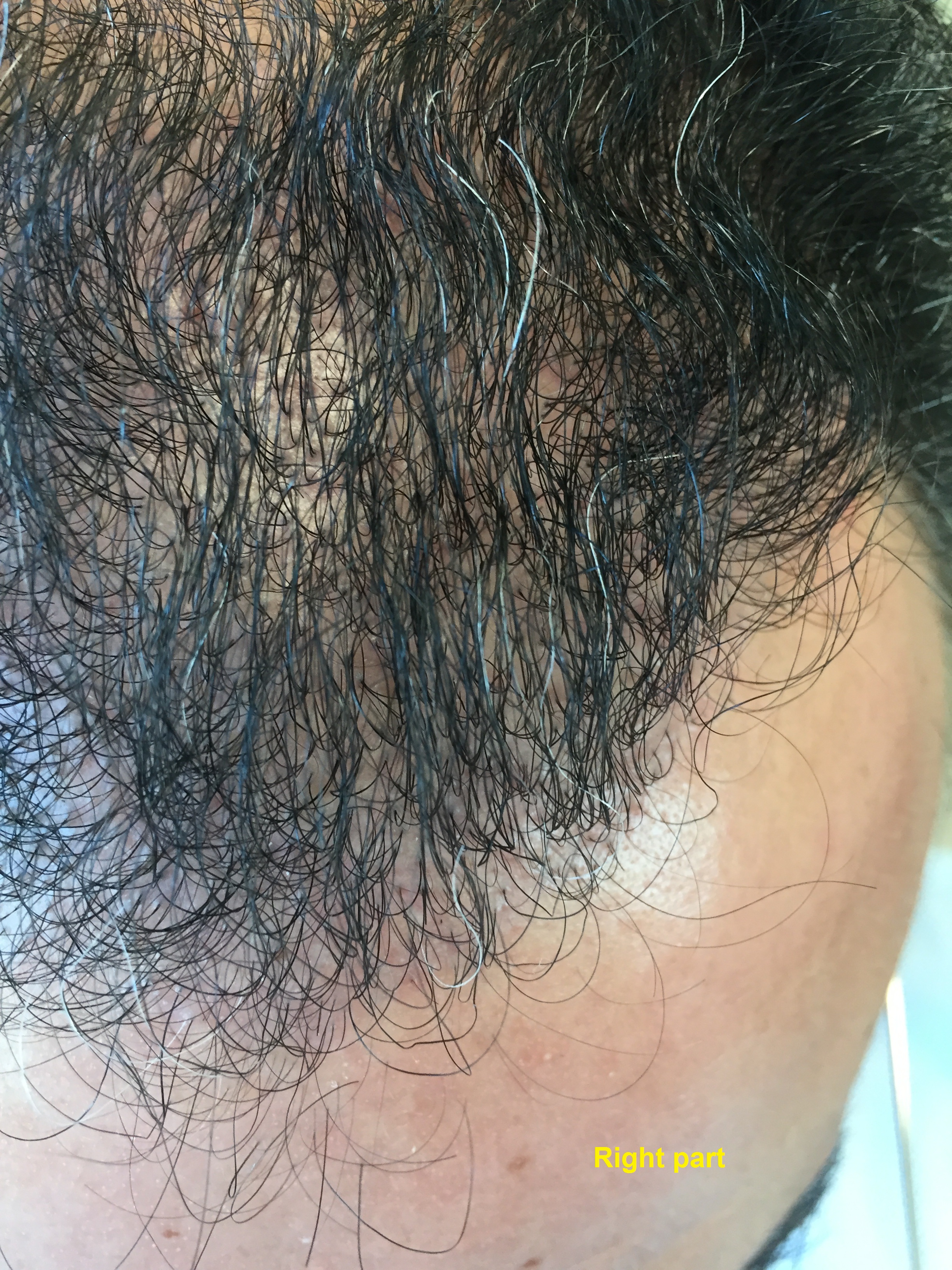 hairline 6m - 2.jpg