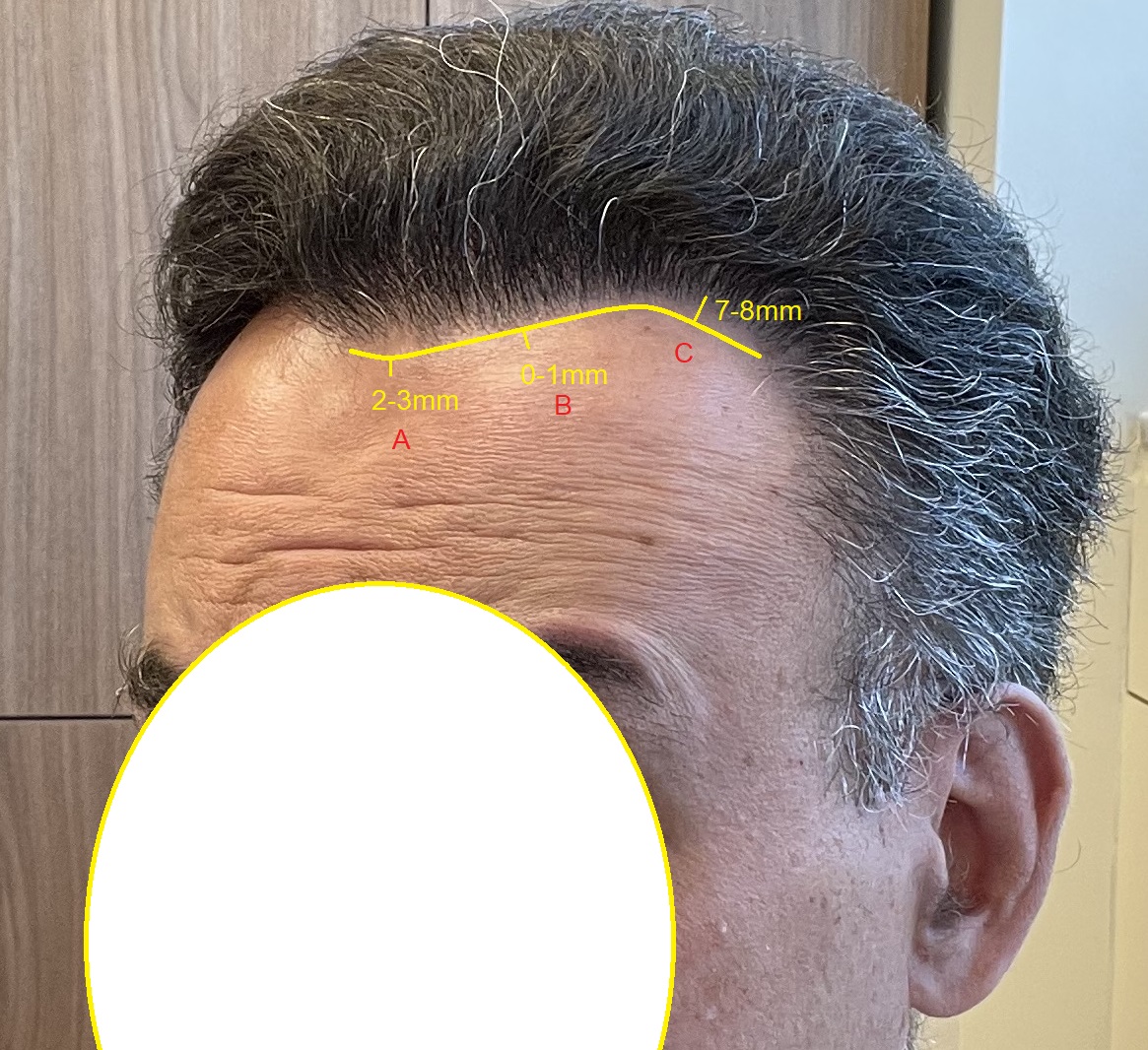 hairline design.jpg