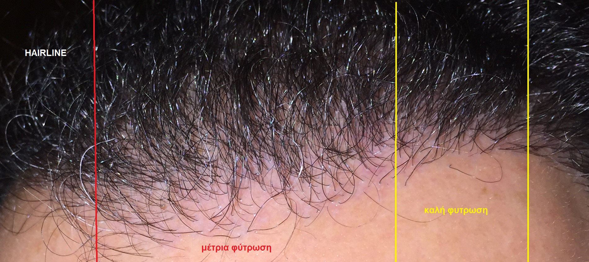 HAIRLINE.jpg