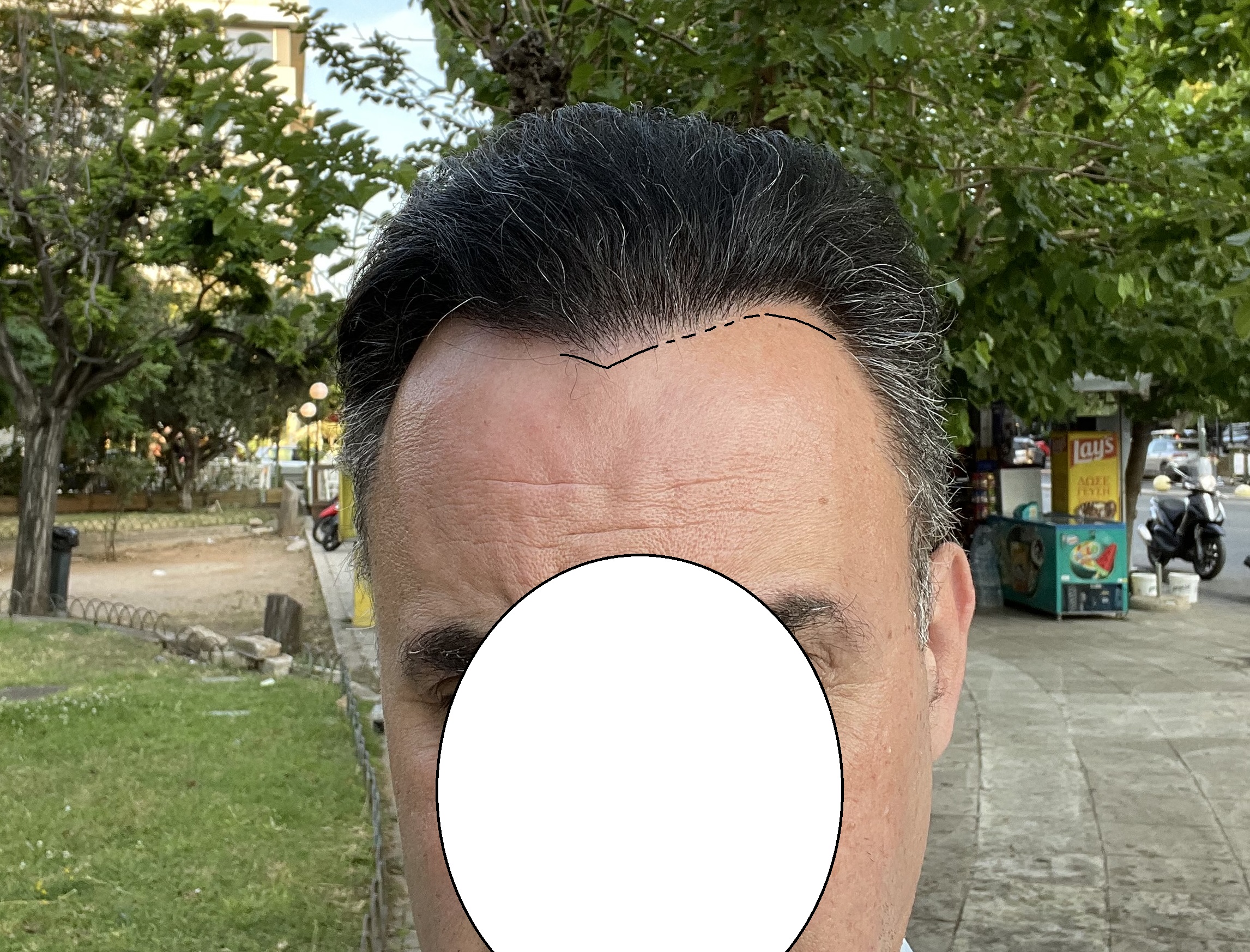 hairline.jpg
