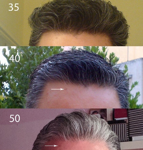 hairline.jpg