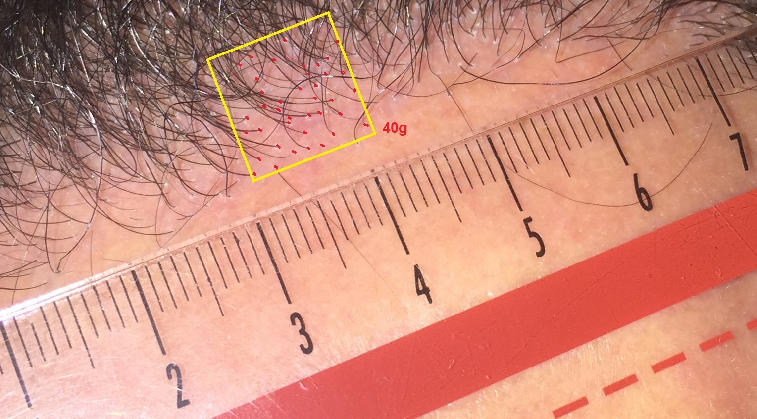 hairline26-02-2016.jpg