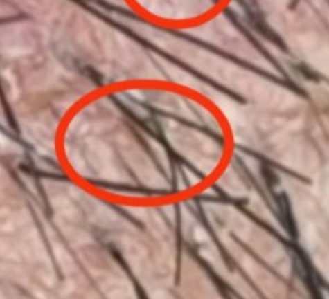 hatzi1.jpg