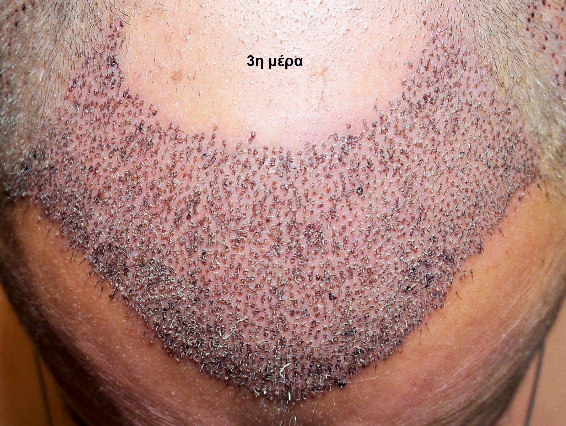 HEALING1 (2).jpg