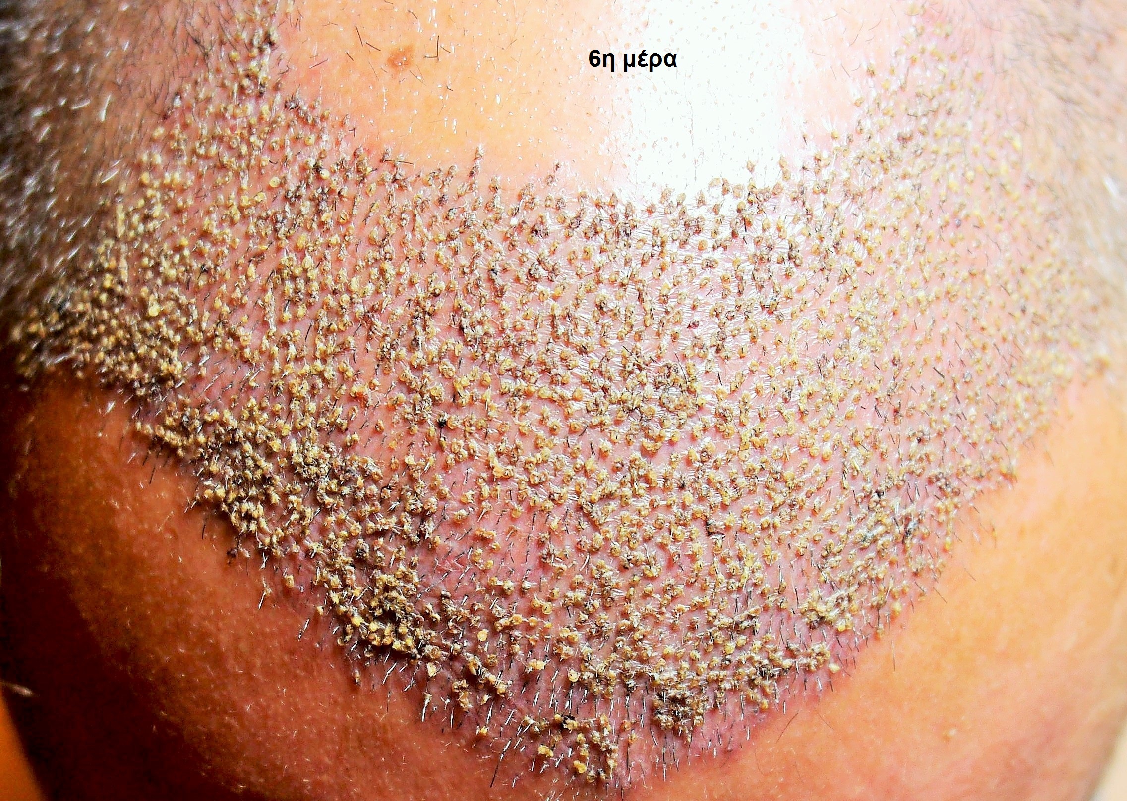 HEALING2 (2).jpg