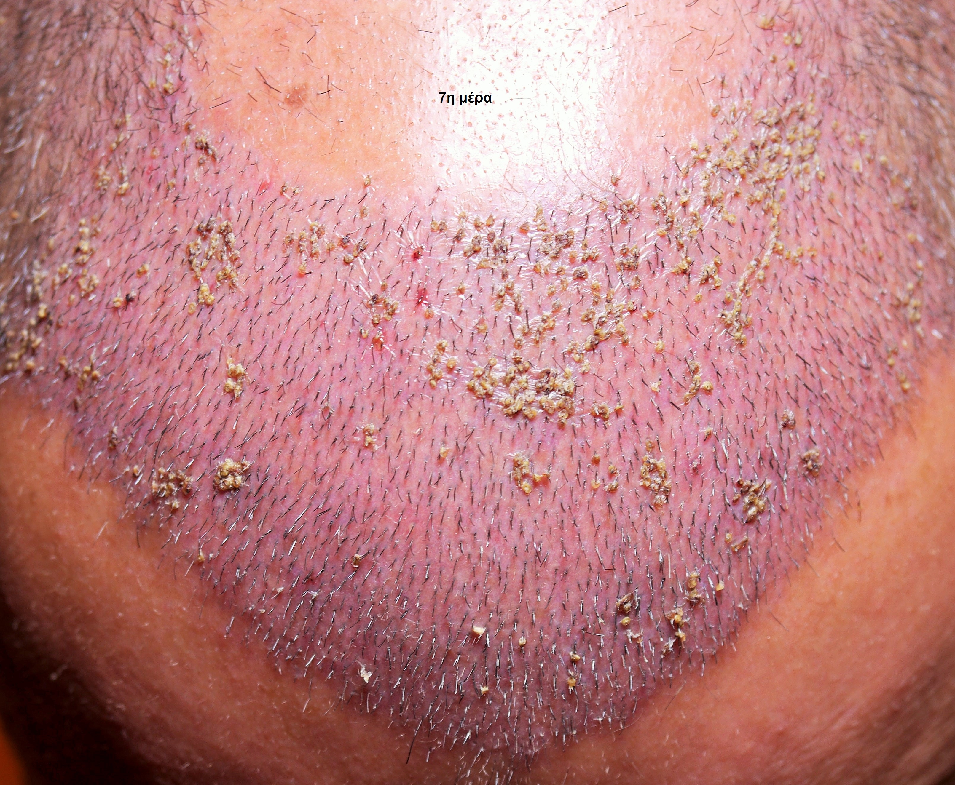 HEALING3 (2).jpg