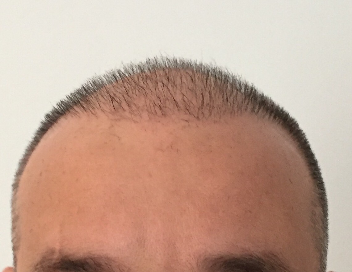 ImageUploadedByTapatalk1457185434.320986.jpg