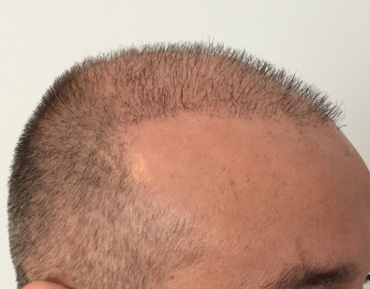 ImageUploadedByTapatalk1457185456.189586.jpg