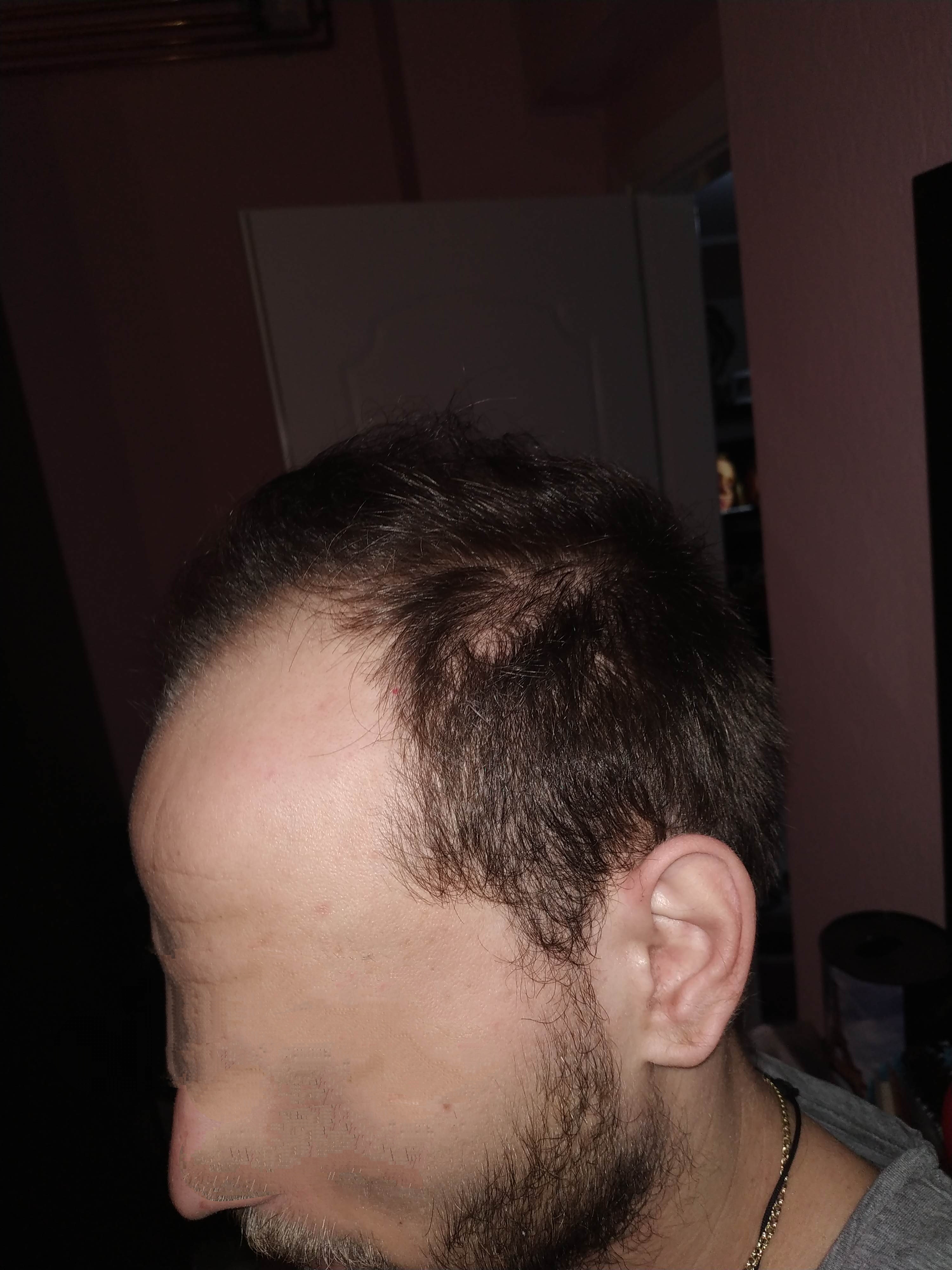 IMG-20190305-020420.jpg