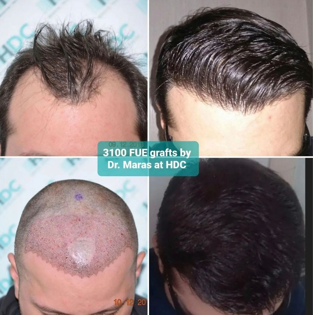 IMG-efe15f90cdbe8a8a0e3acfb123d0d683-V~3.jpg
