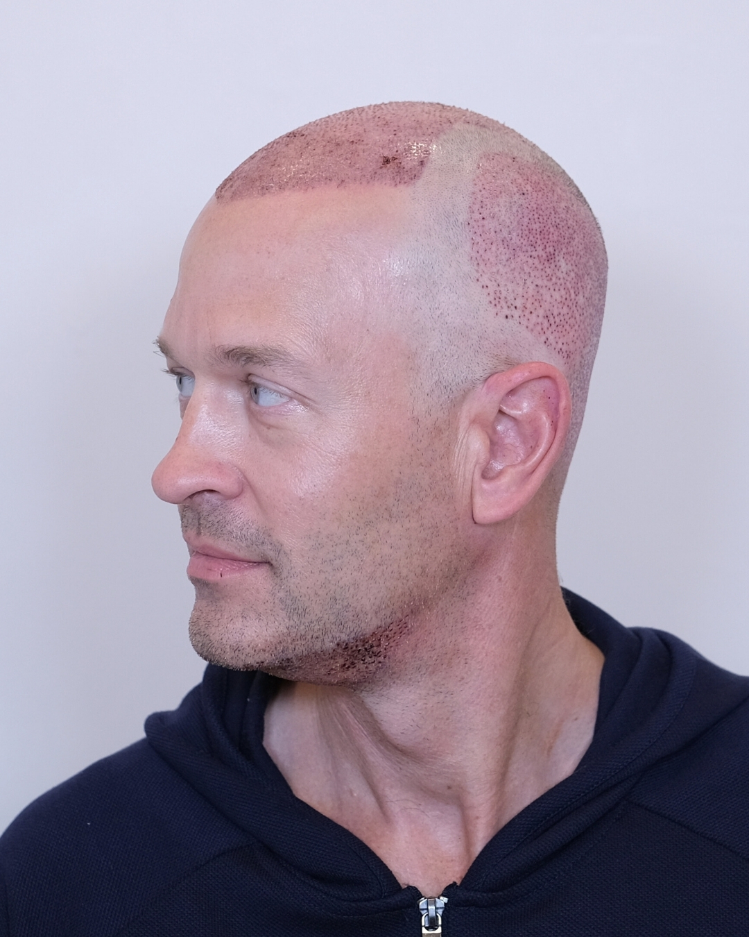 Joseph Jackson B&A5.jpg