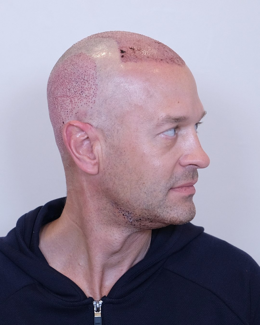 Joseph Jackson B&A8.jpg