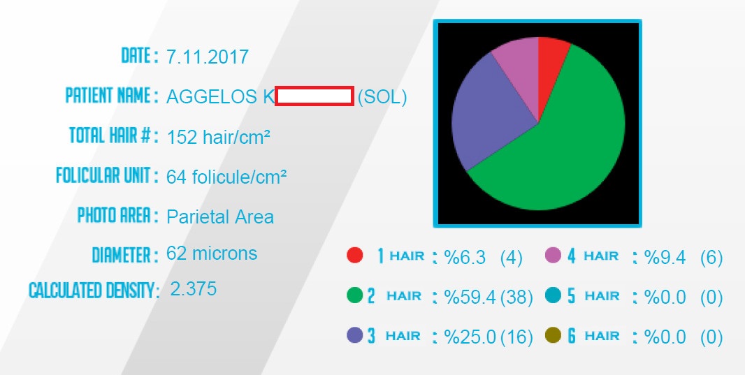 Left Parietal Stats (2).jpg