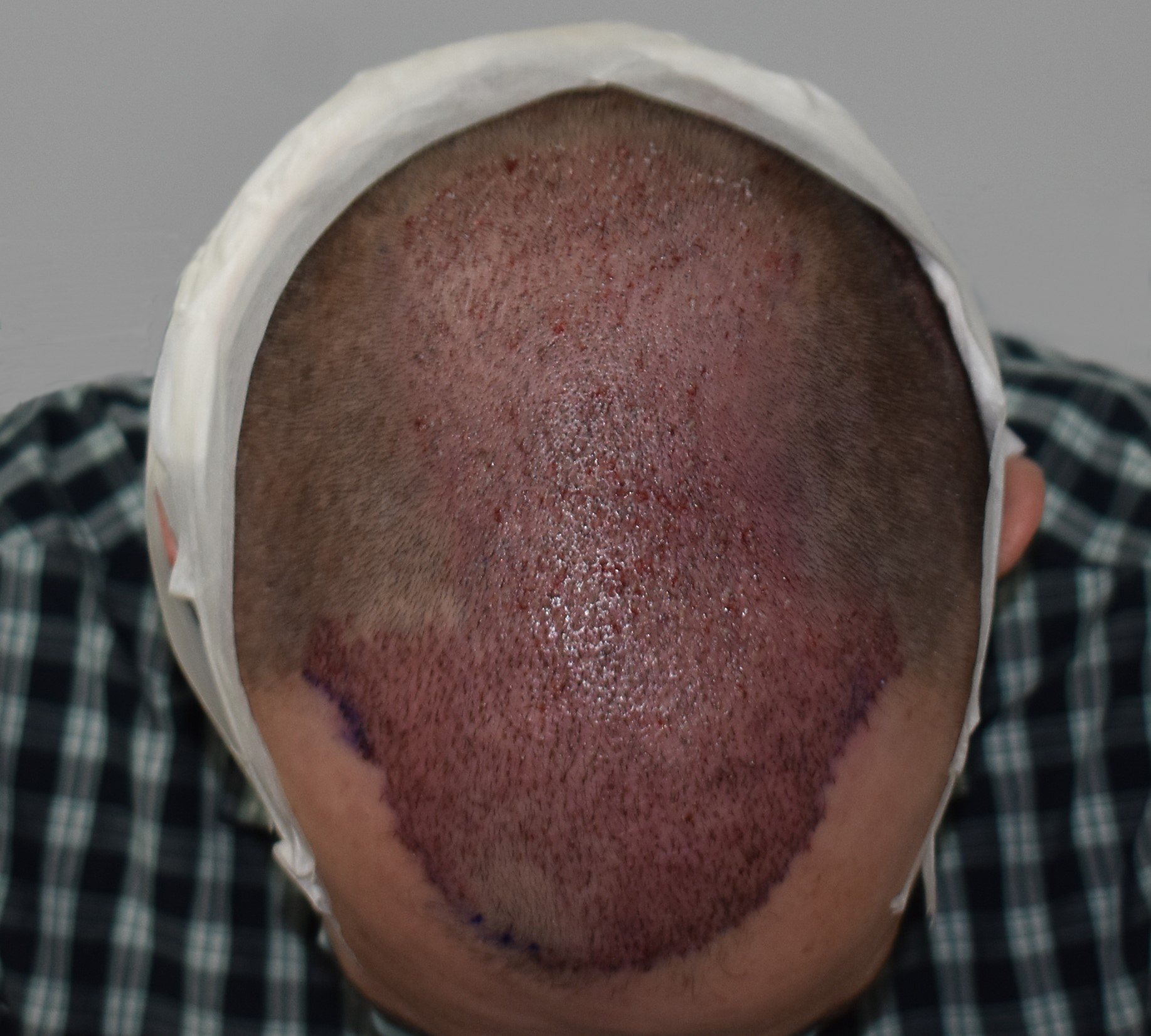 MicrosoftTeams-image (1).jpg