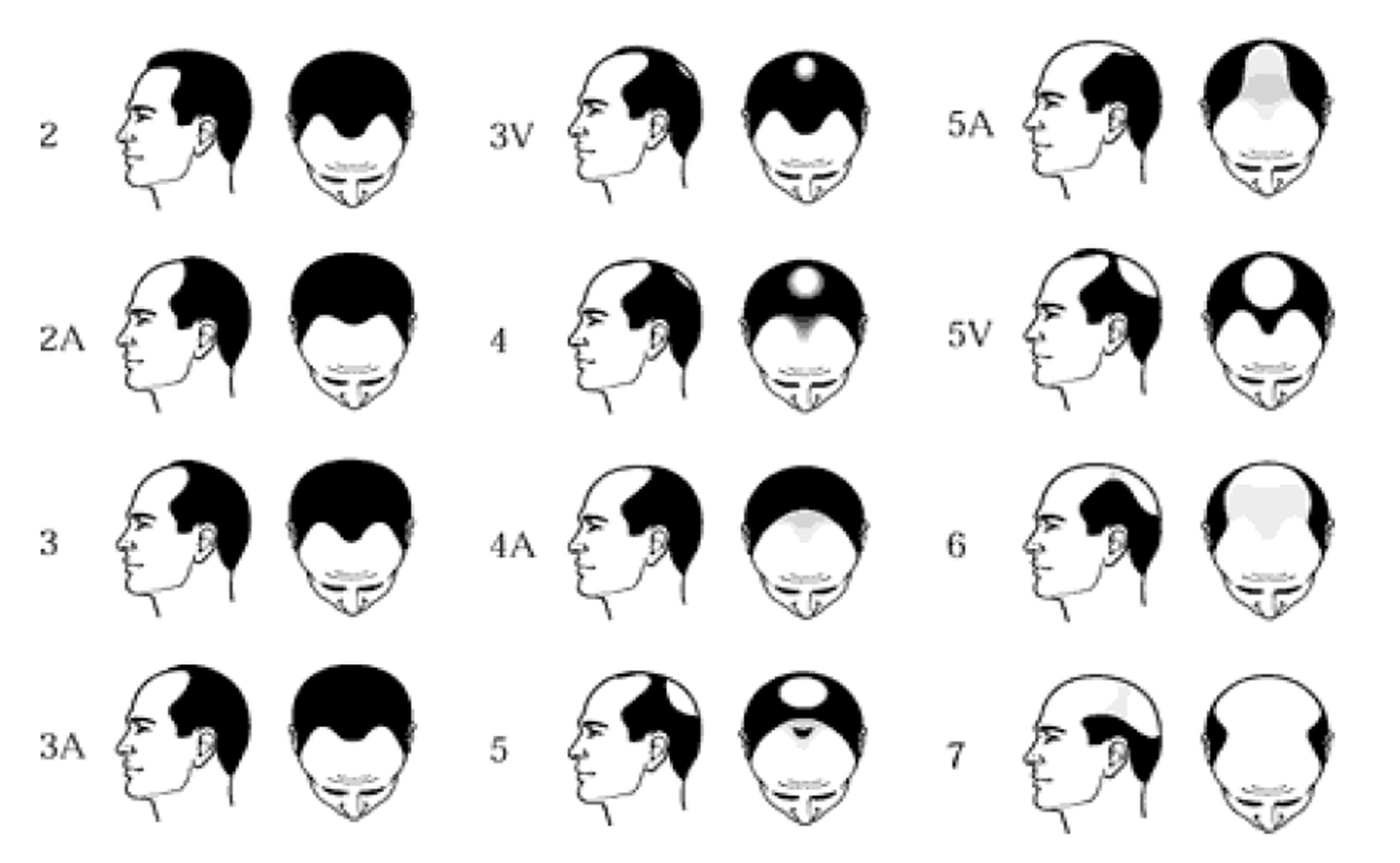 norwood-scale-full2.jpg