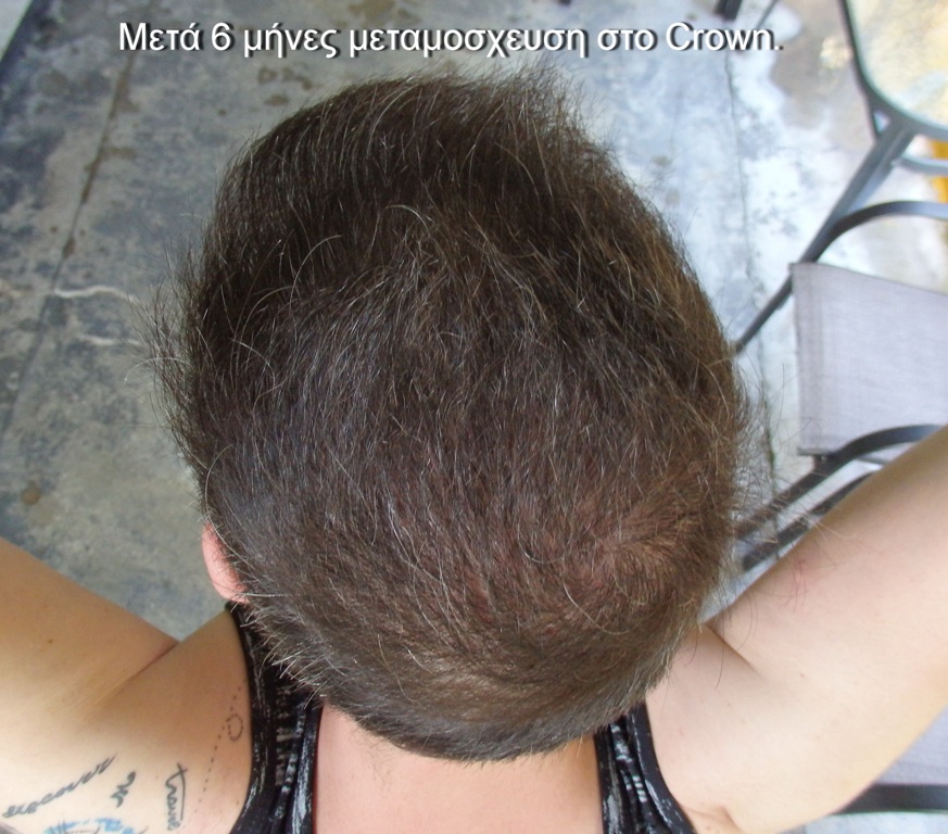 P9146594.JPG