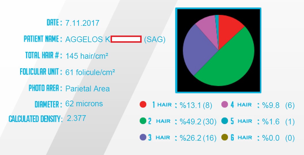 Right Parietal Stats (2).jpg