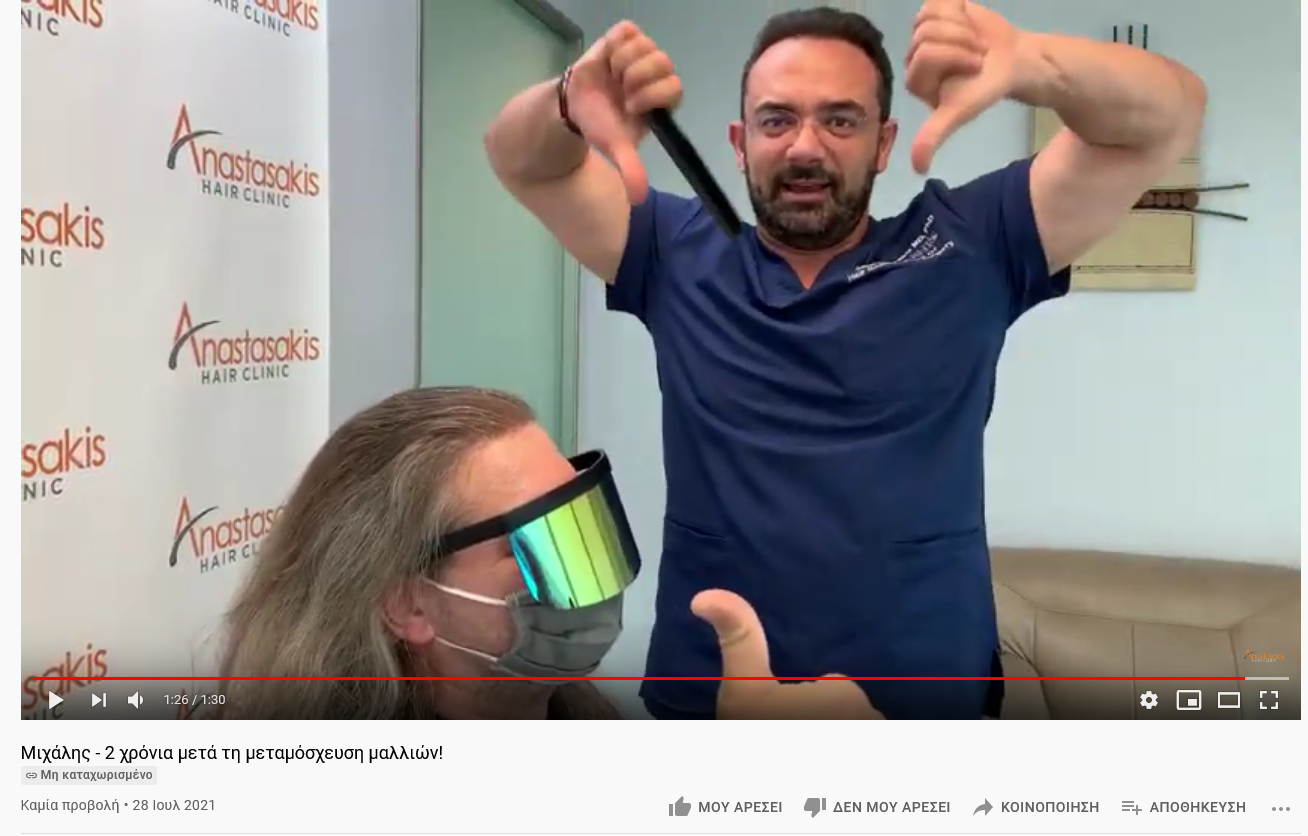 Screenshot 2021-07-28 at 16-20-37 Μιχάλης - 2 χρόνια μετά τη μεταμόσχευση μαλλιών .png