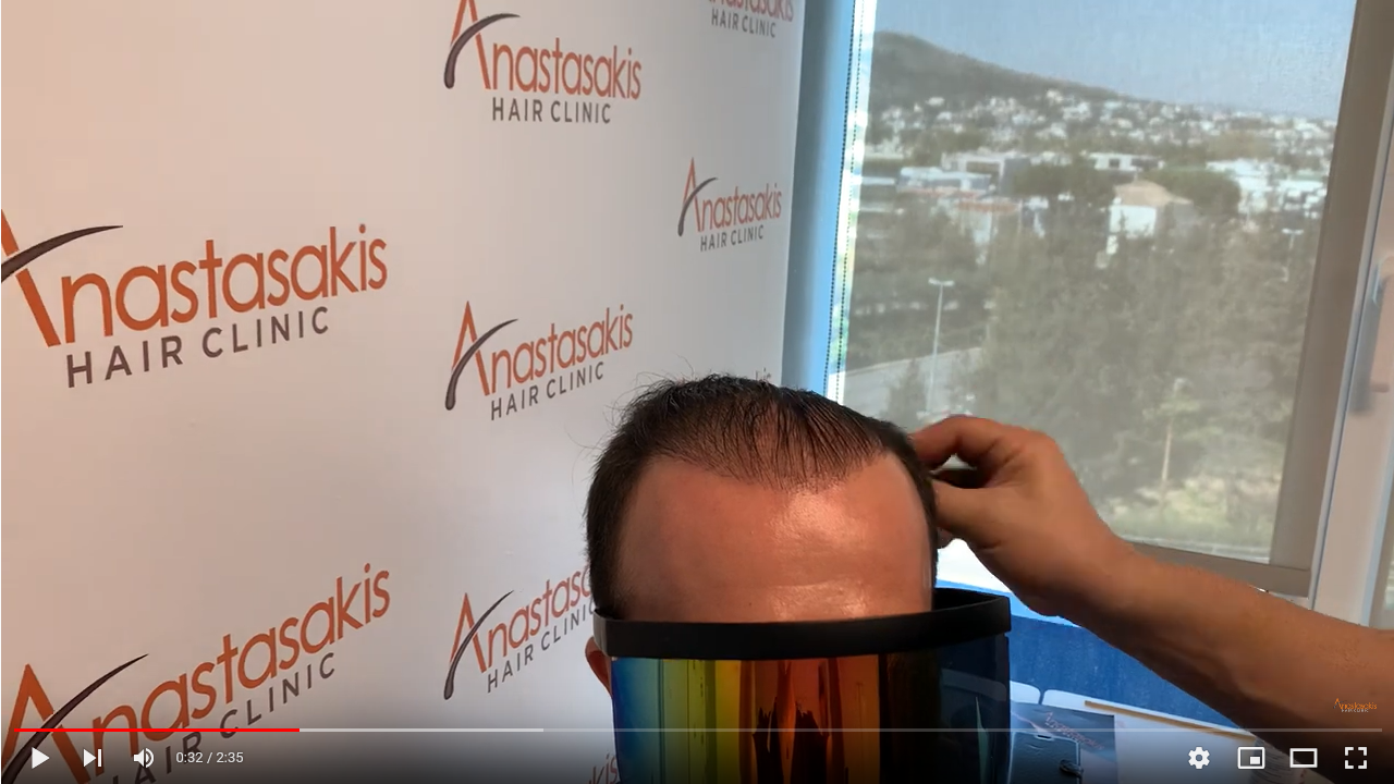 Screenshot 2021-11-17 at 12-26-25 Hairlossgr forum - Αποτέλεσμα μετά από 4 ΜΜ - part 1.png