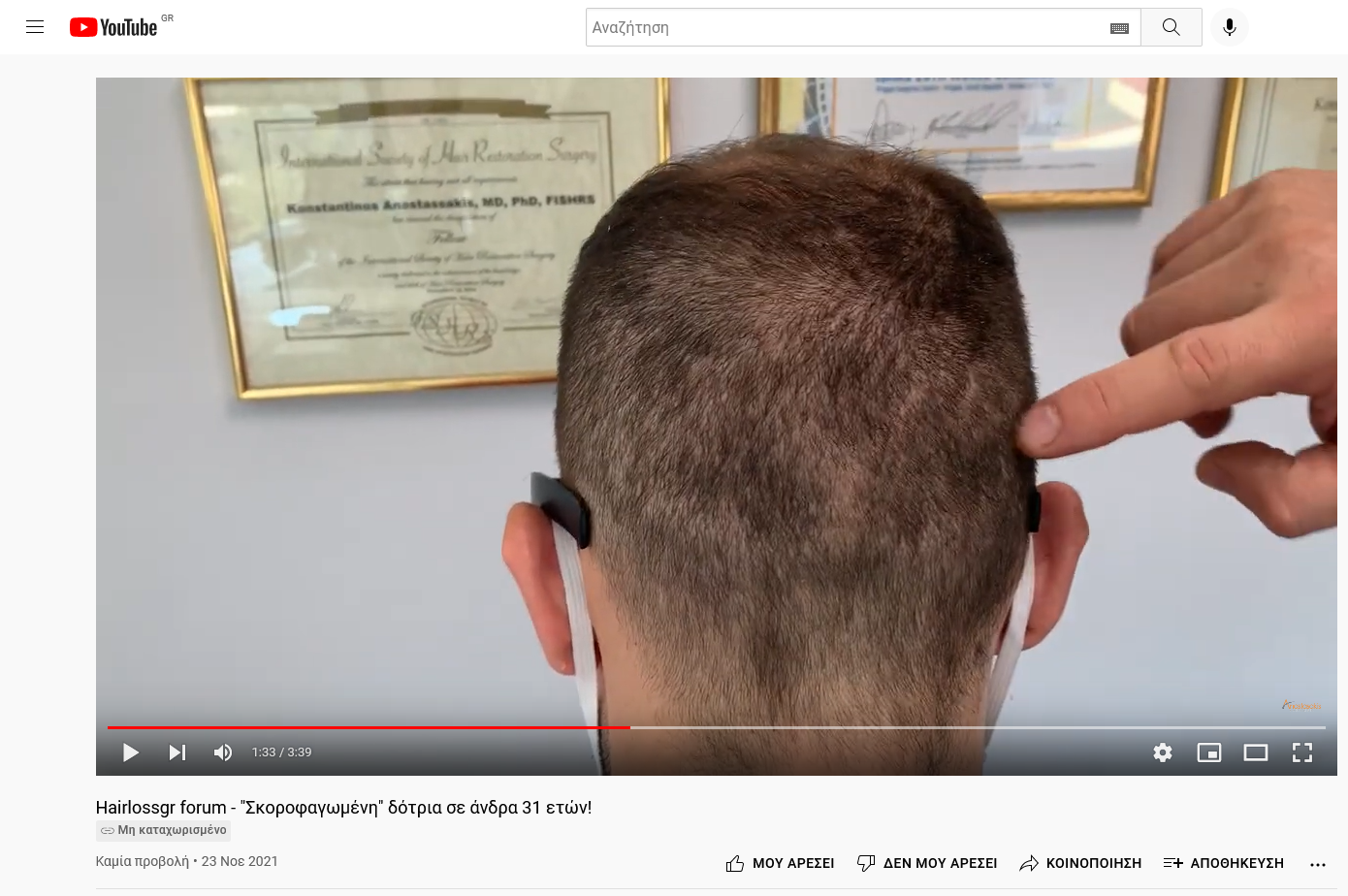 Screenshot 2021-11-23 at 17-18-18 Hairlossgr forum - Σκοροφαγωμένη δότρια σε άνδρα 31 ετών .png