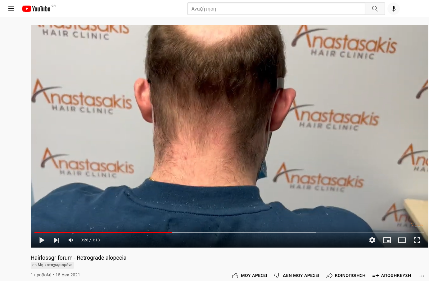 Screenshot 2021-12-15 at 18-24-19 Hairlossgr forum - Retrograde alopecia.png