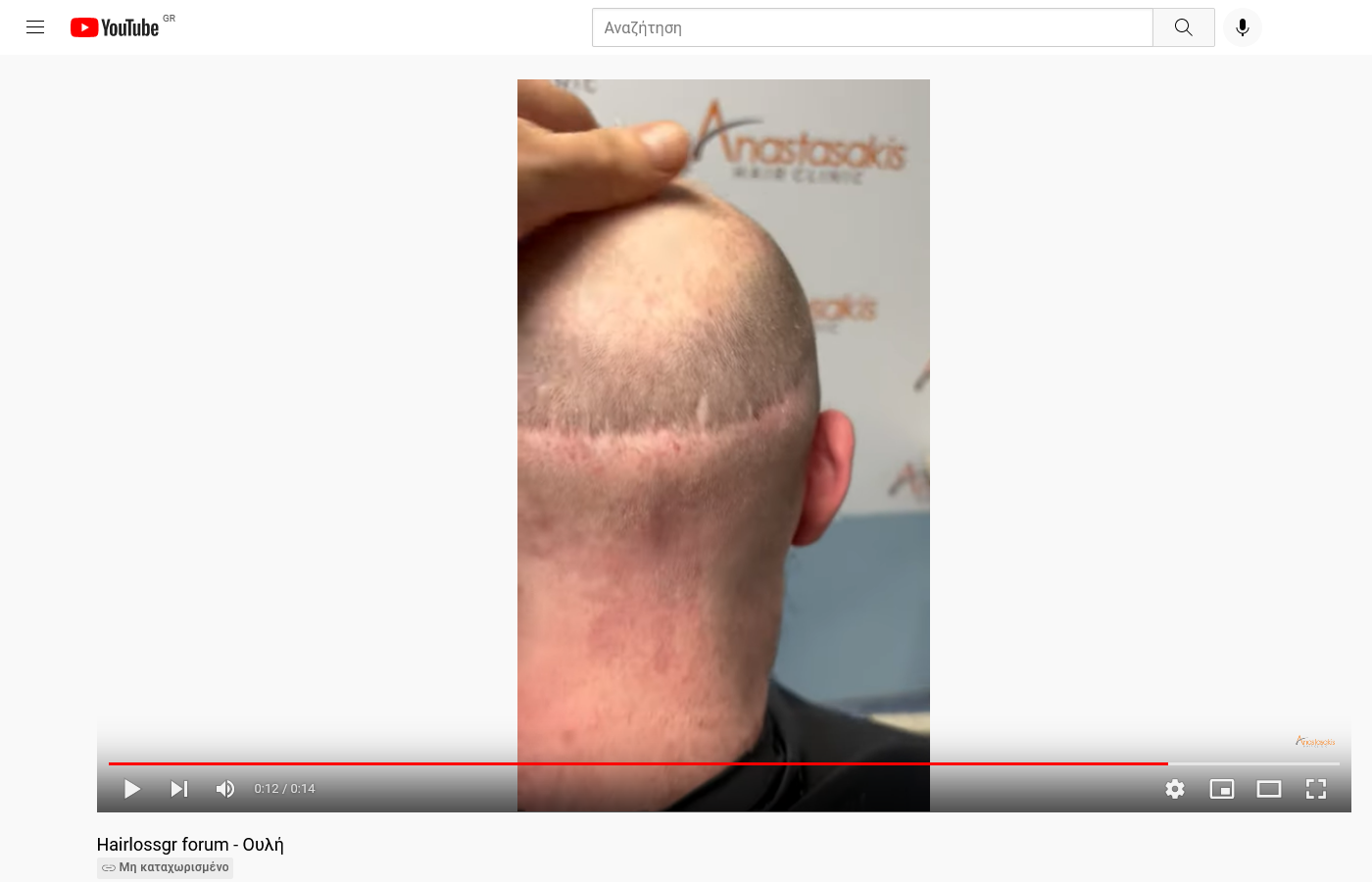 Screenshot 2021-12-16 at 17-15-12 Hairlossgr forum - Ουλή.png