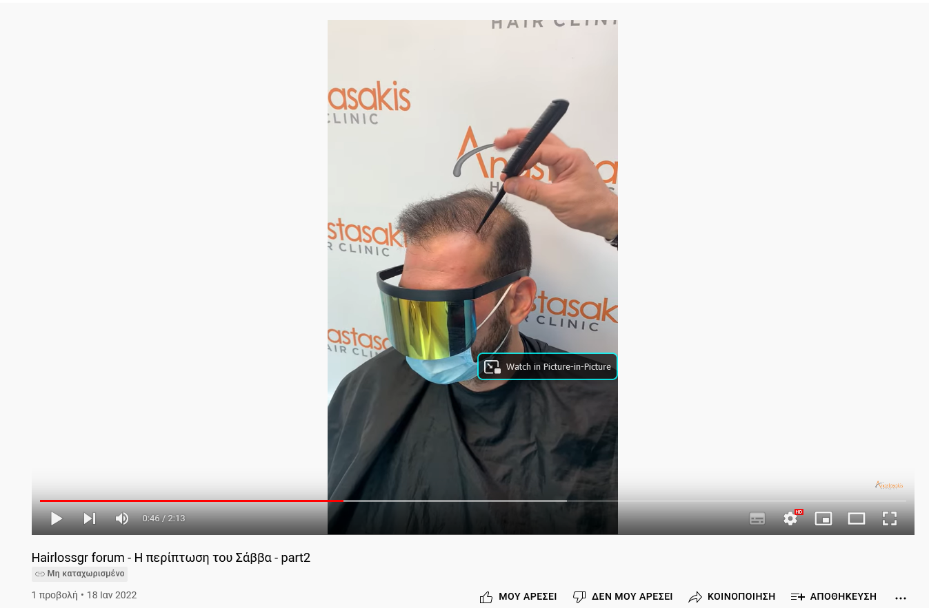 Screenshot 2022-01-20 at 14-15-54 Hairlossgr forum - Η περίπτωση του Σάββα - part2.png
