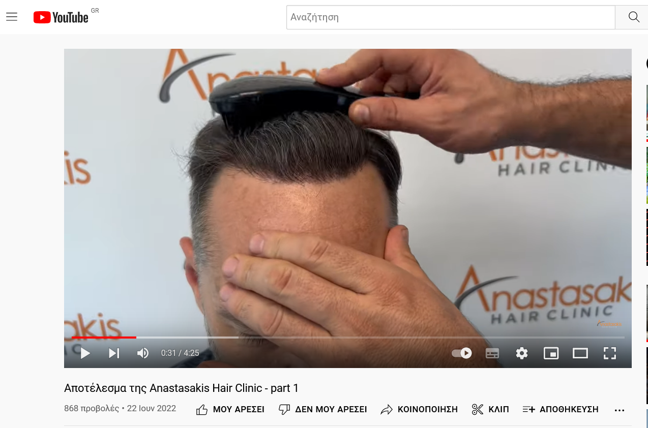 Screenshot 2022-06-23 at 10-05-09 Αποτέλεσμα της Anastasakis Hair Clinic - part 1.png