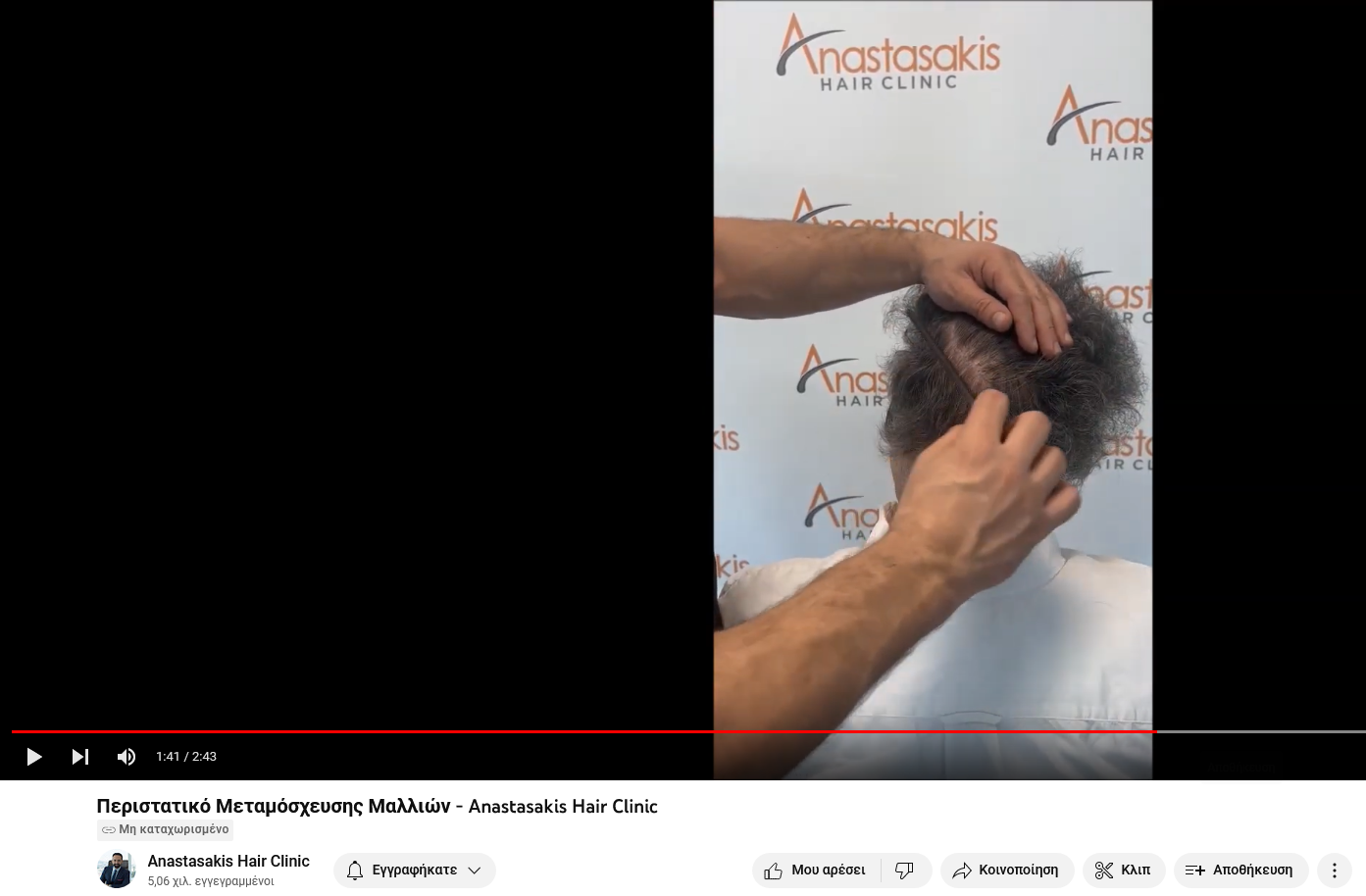 Screenshot 2023-06-13 at 12-07-51 Περιστατικό Μεταμόσχευσης Μαλλιών - Anastasakis Hair Clinic.png