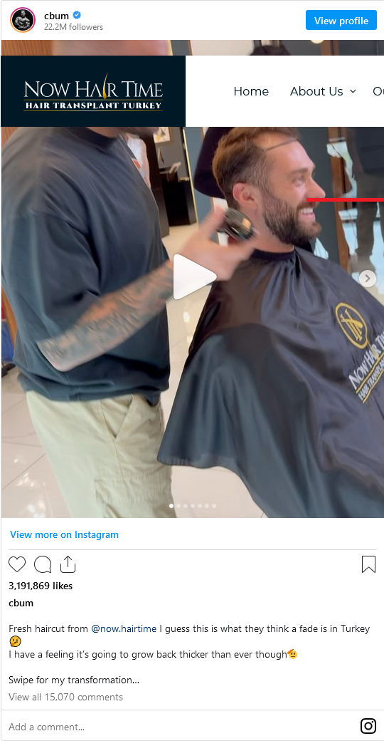 Screenshot 2023-12-12 at 19-01-40 Chris Bumstead got hair transplant in Now Hair Time 1.png
